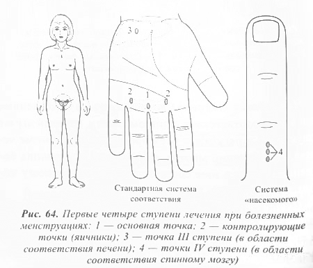 Первые четыре ступени лечения при болезненных менструациях