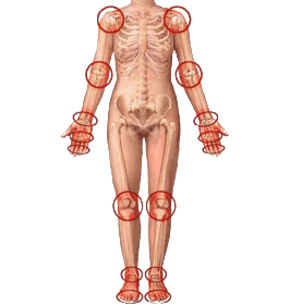 Очистка суставов